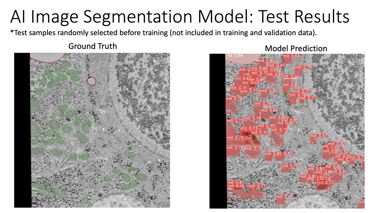 EM Cell Segmentation Image